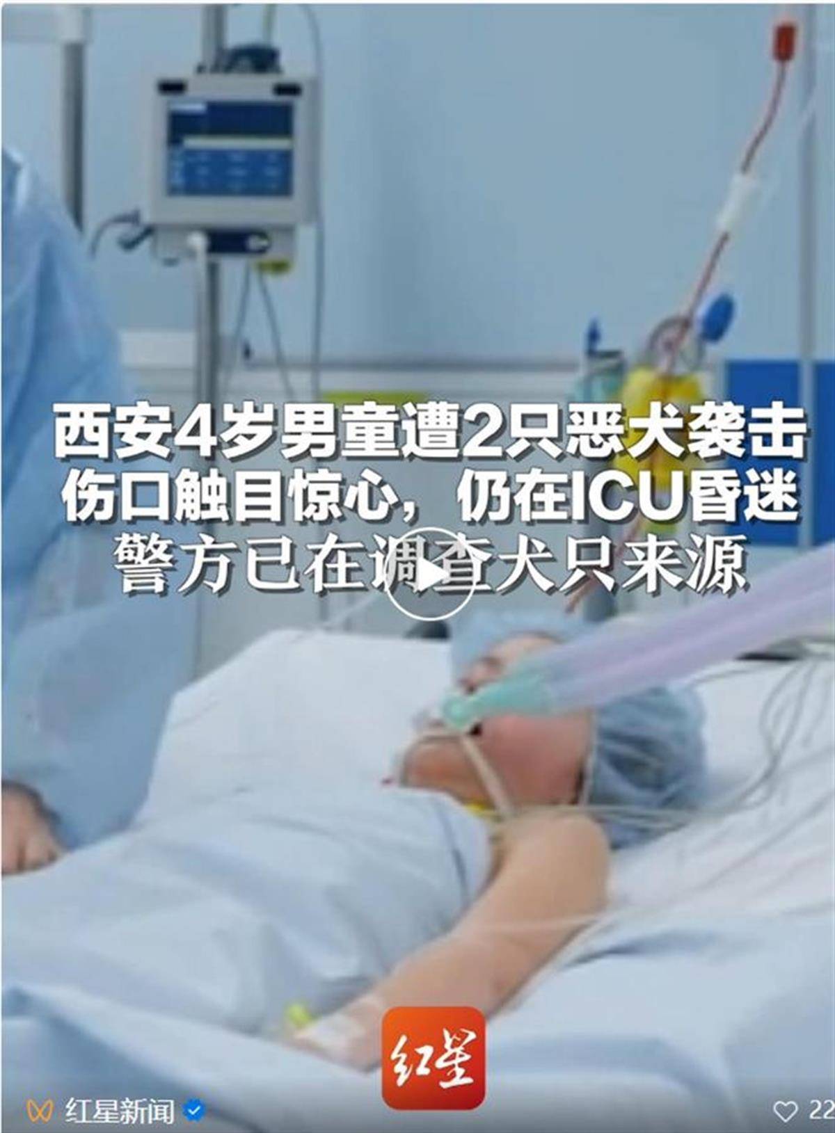 4歲男童遭惡犬襲擊住進ICU，狗咬人為何就管不住？